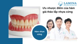 Hàm tháo lắp nhựa cứng