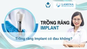 Trồng răng Implant có đau không?