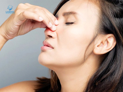 hôi miệng từ cổ họng: viêm xoang