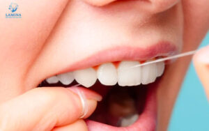 răng bị đen trên bề mặt: vệ sinh răng miệng kém