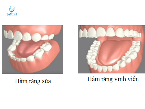răng hàm có thay không so sánh răng sữa và vĩnh viễn