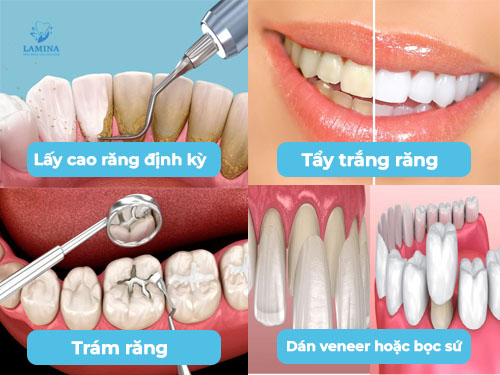 răng có vết đen: cách khắc phục