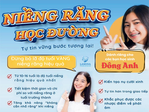 lý do nên niềng răng