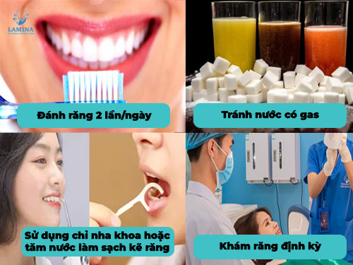 răng cấm là răng nào: cách chăm sóc