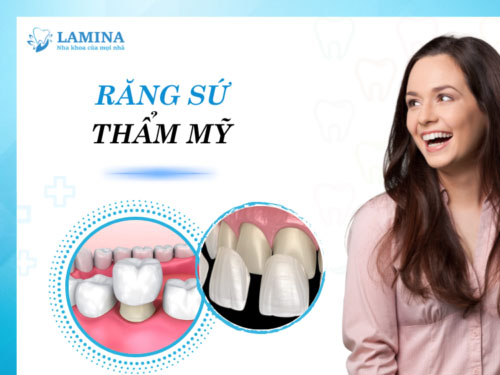 bọc sứ khi răng cửa mọc lệch