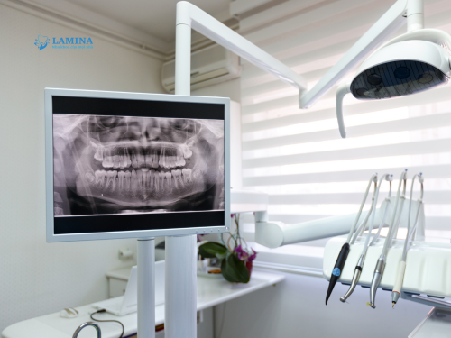 chụp x quang răng khôn bao nhiêu tiền