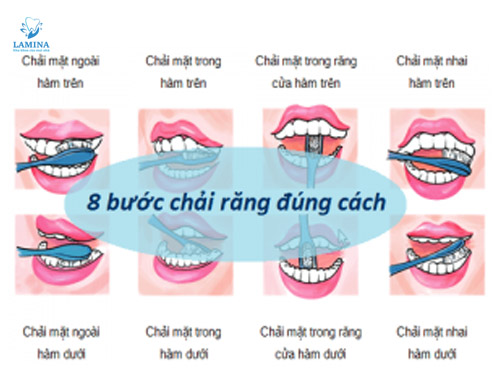 tụt lợi hàm dưới điều trị