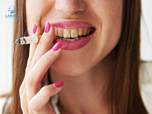 Trị viêm nha chu tại nhà: Hút thuốc lá