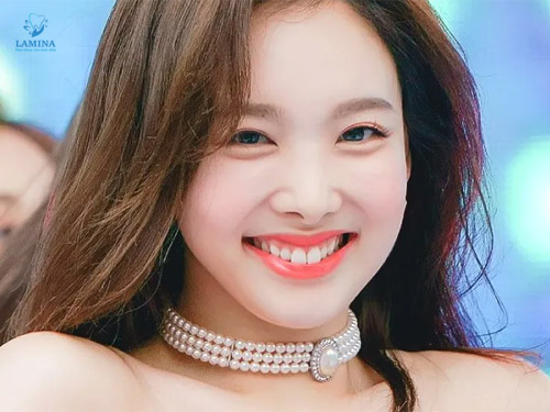 răng thỏ thẩm mỹ