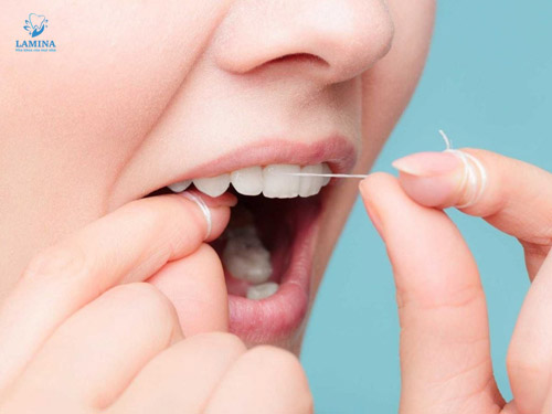 trị viêm nha chu tại nhà: dùng chỉ nha khoa