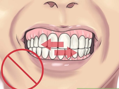 viêm nha chu uống thuốc gì: chải răng sai cách