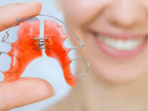 Niềng răng có được vĩnh viễn không? Sự thật ai cũng nên biết trước khi chỉnh nha