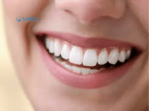 Răng thỏ hô là gì? Răng thỏ có bị hô không và cách khắc phục hiệu quả