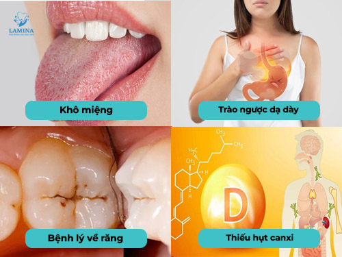nguyên nhân men răng yếu từ cơ thể