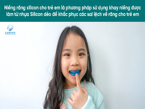 niềng răng silicon cho bé