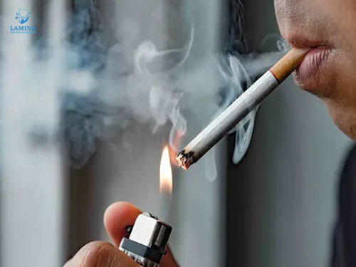 răng bị đen: hút thuốc lá