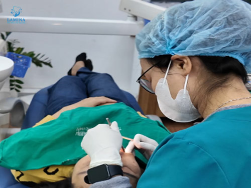 u men răng: phẫu thuật