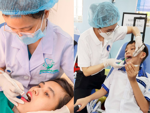 sâu răng có gây hôi miệng không: điều trị bệnh lý triệt để