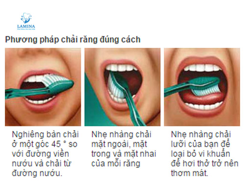 sâu răng có gây hôi miệng không: cách vệ sinh răng