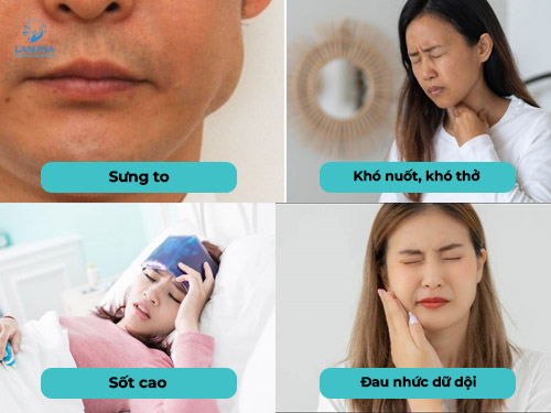lấy tuỷ xong bị sưng mặt bị nguy hiểm