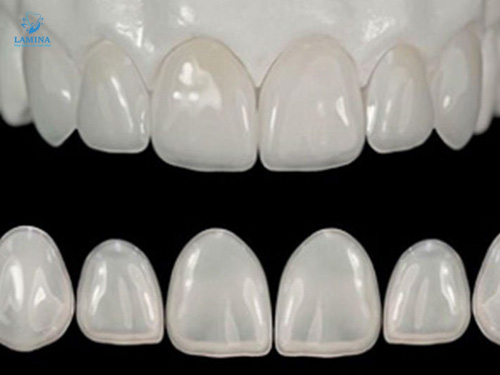 địa chỉ bọc răng sứ đông anh: nguồn gốc chính hãng