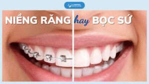 nen-nieng-rang-hay-boc-su