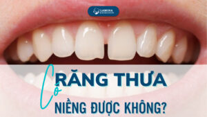 rang-thua-co-nieng-duoc-khong