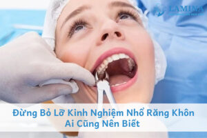 Kinh nghiệm nhổ răng khôn điều ai cũng nên biết