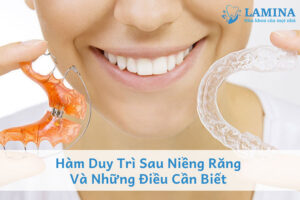 Hàm duy trì sau niềng răng và những điều cần biết