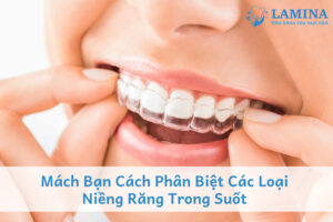 Mách bạn cách phân biệt các loại niềng răng trong suốt