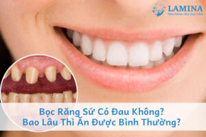 Bọc răng sứ có đau không?