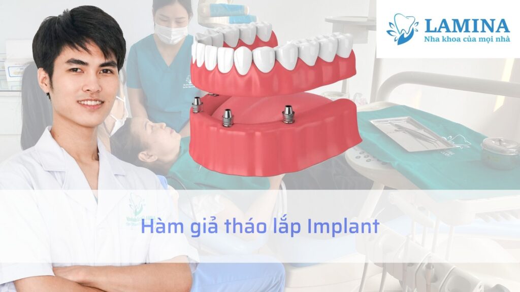 Hàm giả tháo lắp Implant
