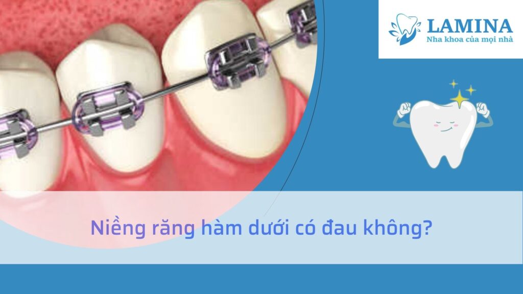 niềng răng hàm dưới có đau không