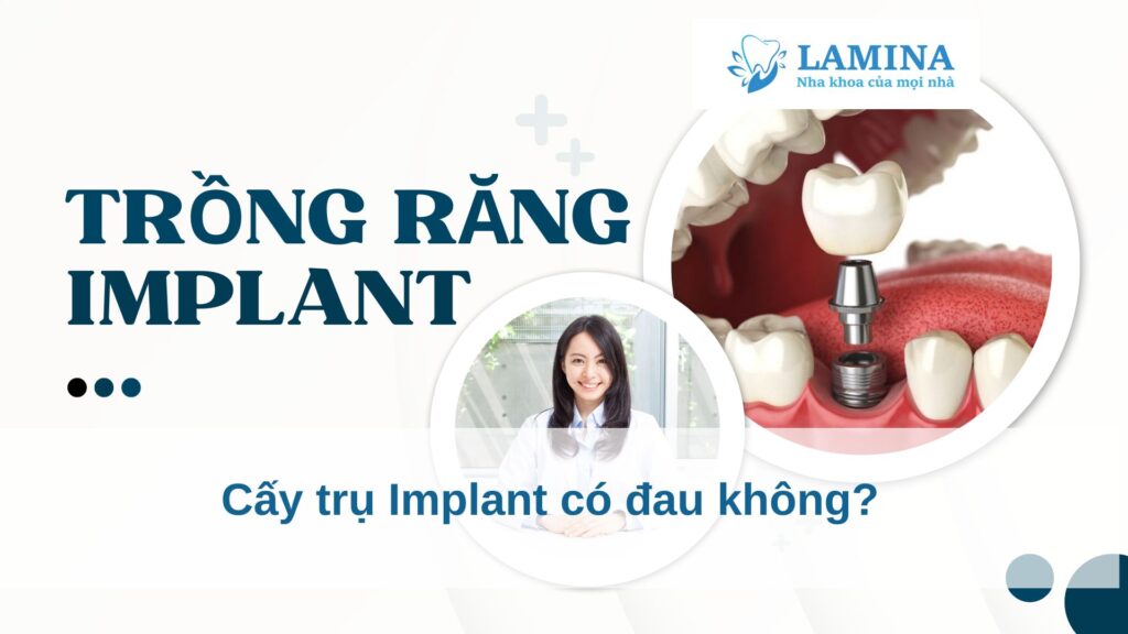 Cấy trụ implant có đau không?