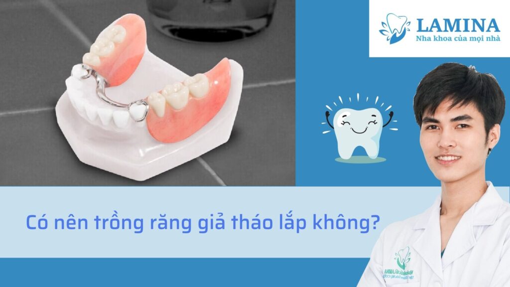 có nên trồng răng hàm giả tháo lắp không