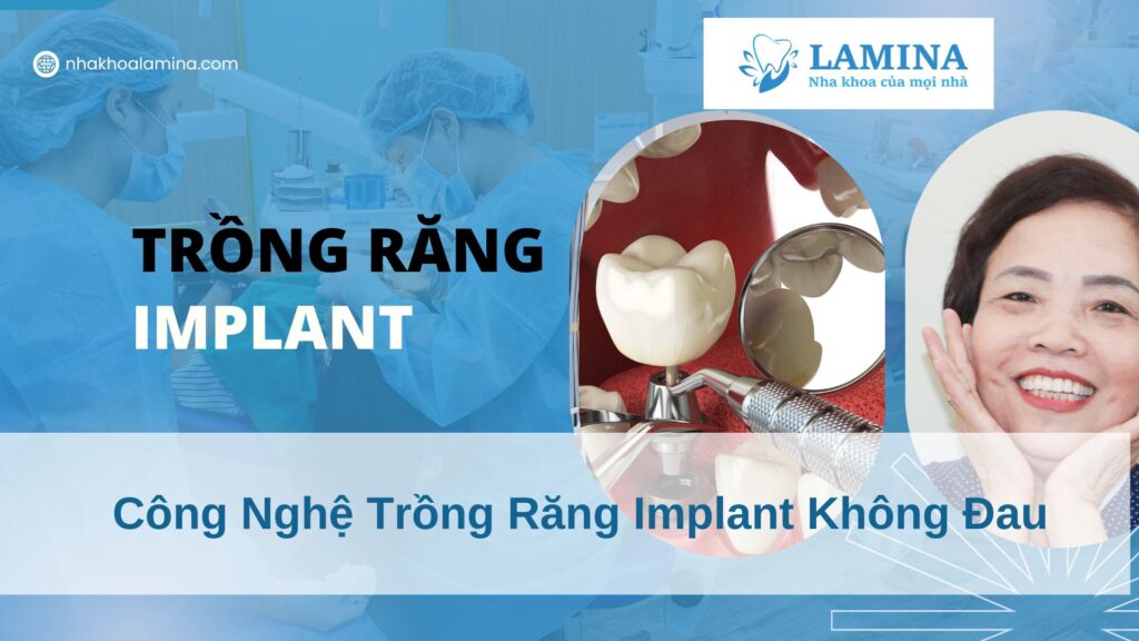 Công nghệ trồng răng Implant không đau