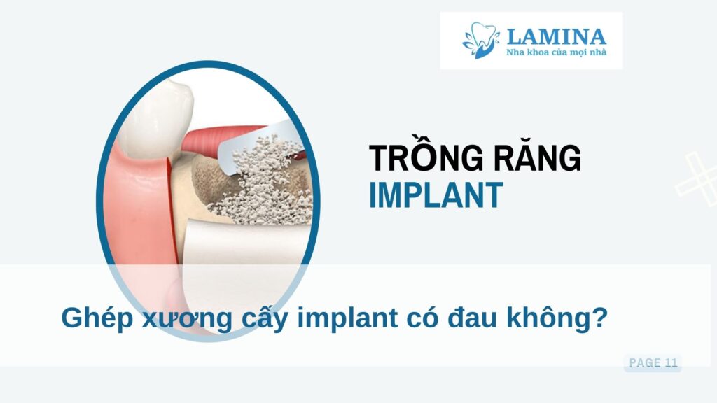 Ghép xương cấy implant có đau không?