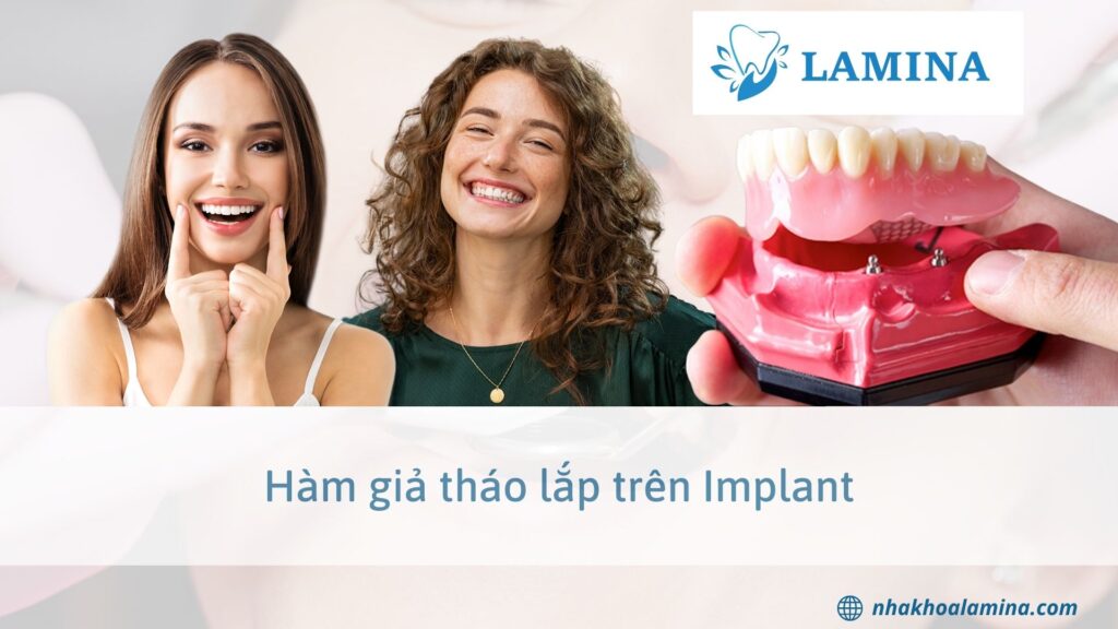 Hàm giả tháo lắp trên Implant