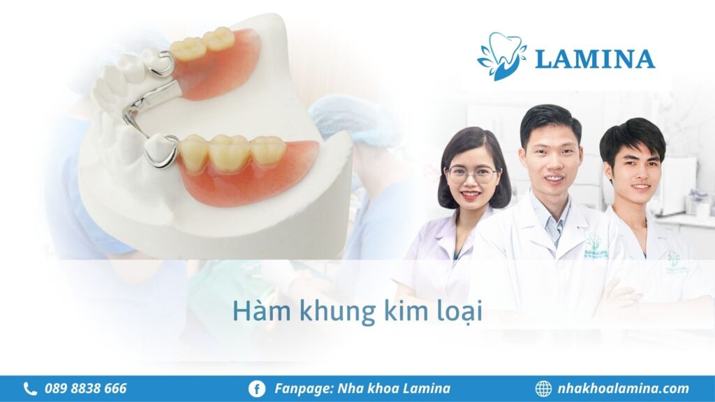 Hàm khung kim loại