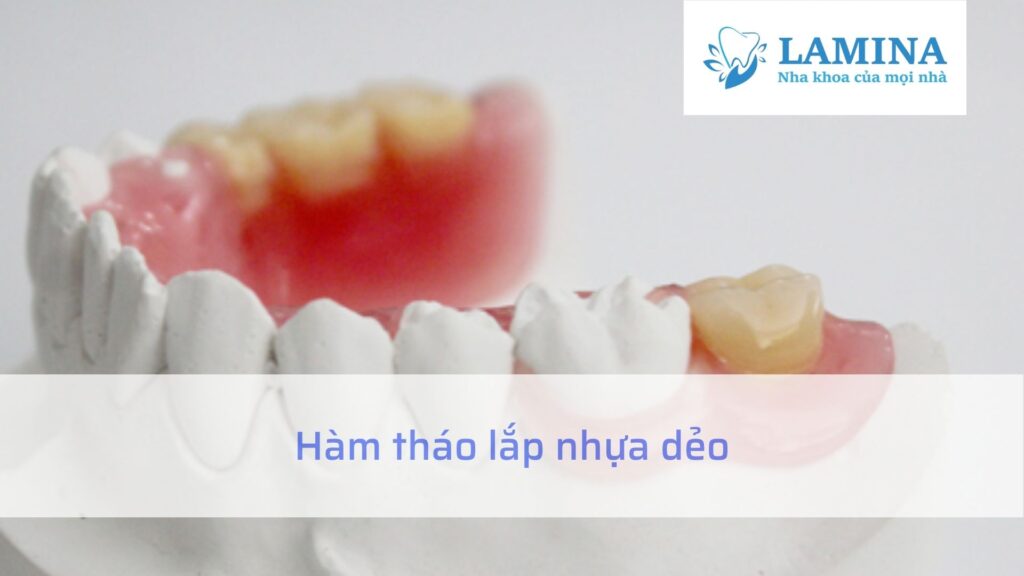 Hàm tháo lắp nhựa dẻo