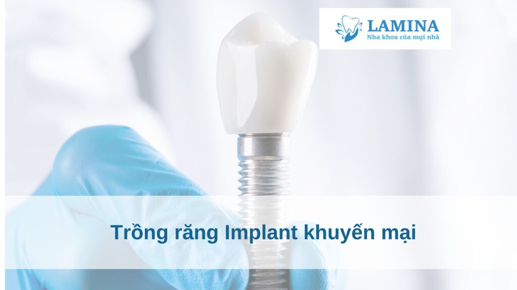 Quy trình trồng răng Implant