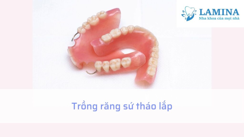 Trồng răng sứ tháo lắp