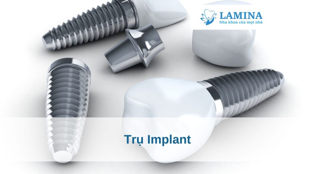 Trụ Implant