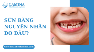 Sún răng nguyên nhân do đâu
