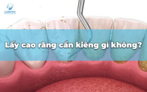 lấy cao răng xong kiêng gì ?