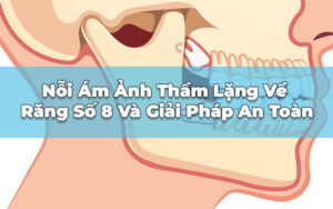 ám ảnh răng 8
