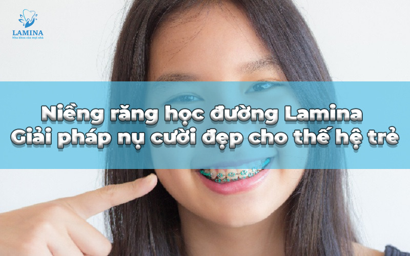 niềng răng học đường lamina
