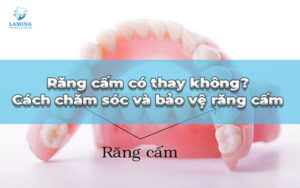 răng cấm có thay không