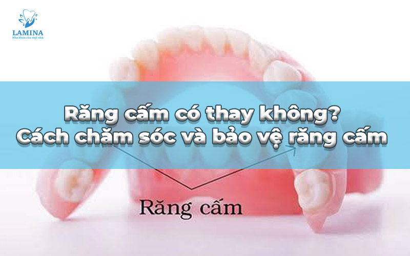 răng cấm có thay không