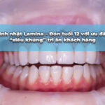 bọc răng sứ toàn sứ